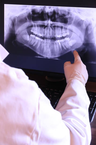 Best Dentist for Tooth Abscess  in New California, OH