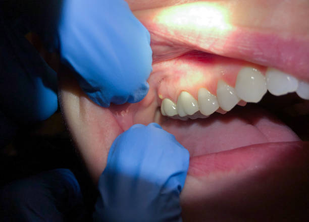 Best Broken Tooth Emergency  in New California, OH